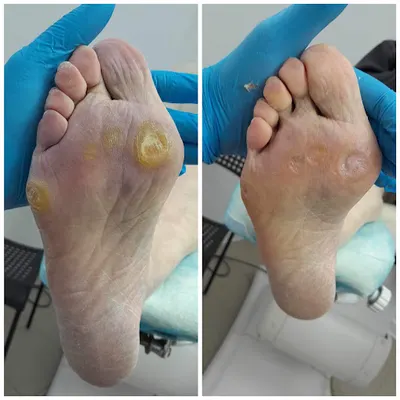 Podolog Kielce Ewa Zapała Czas na Stopy